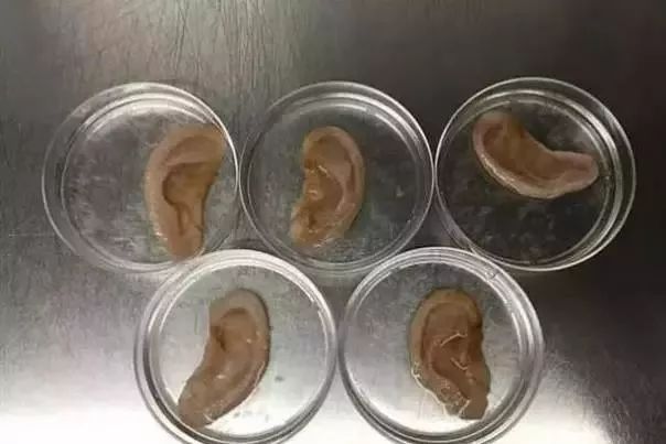 醫(yī)學(xué)黑科技！蘋果造人耳，菠菜做心臟？以后大家可能都是一盤菜…