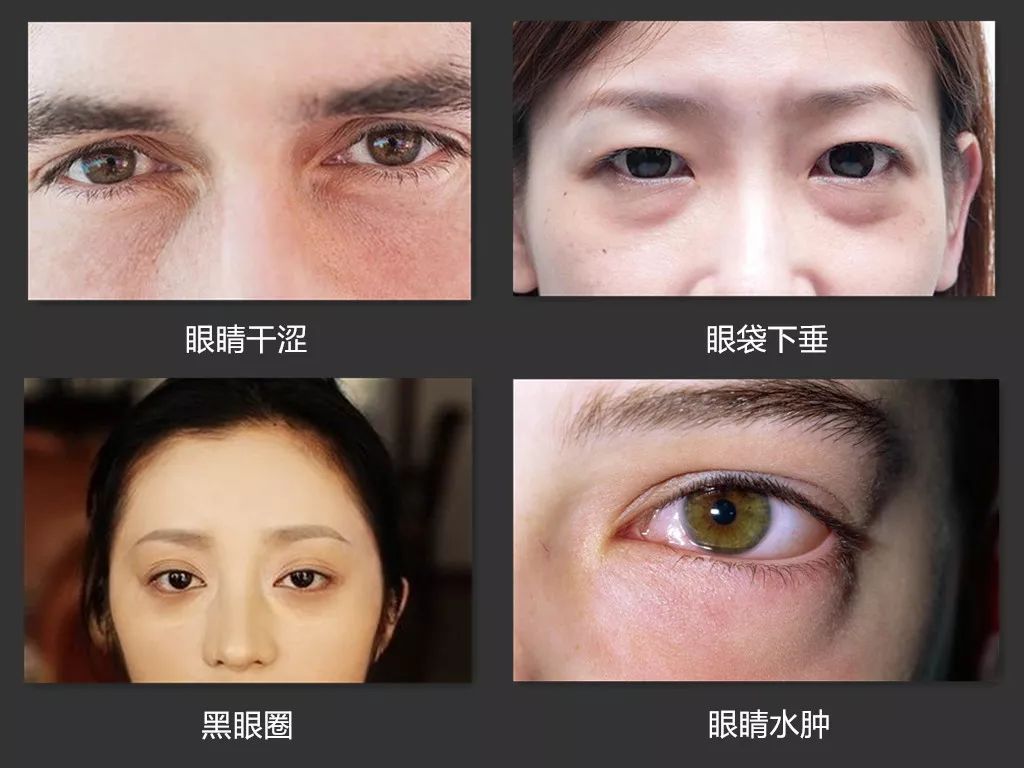 消除眼袋，緩解眼疲勞，黑科技眼罩讓你秒入夢(mèng)鄉(xiāng)，精神煥發(fā)