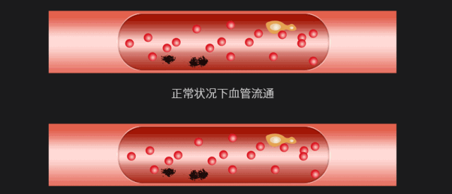 消除眼袋，緩解眼疲勞，黑科技眼罩讓你秒入夢(mèng)鄉(xiāng)，精神煥發(fā)