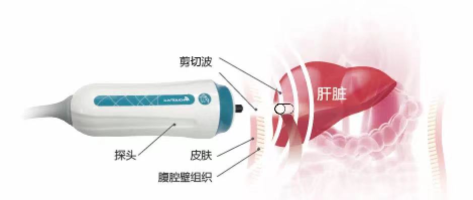 2021全國雙創(chuàng)周開幕！與總理連線對話，海斯凱爾靠什么讓總理點贊？